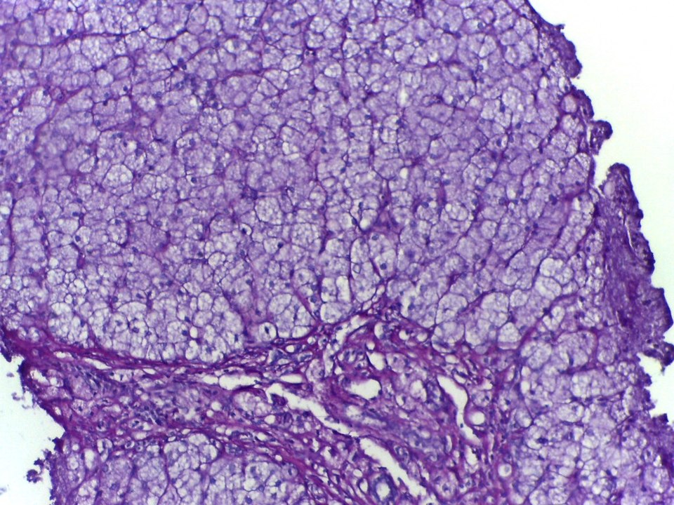 Alejandro Fanconi