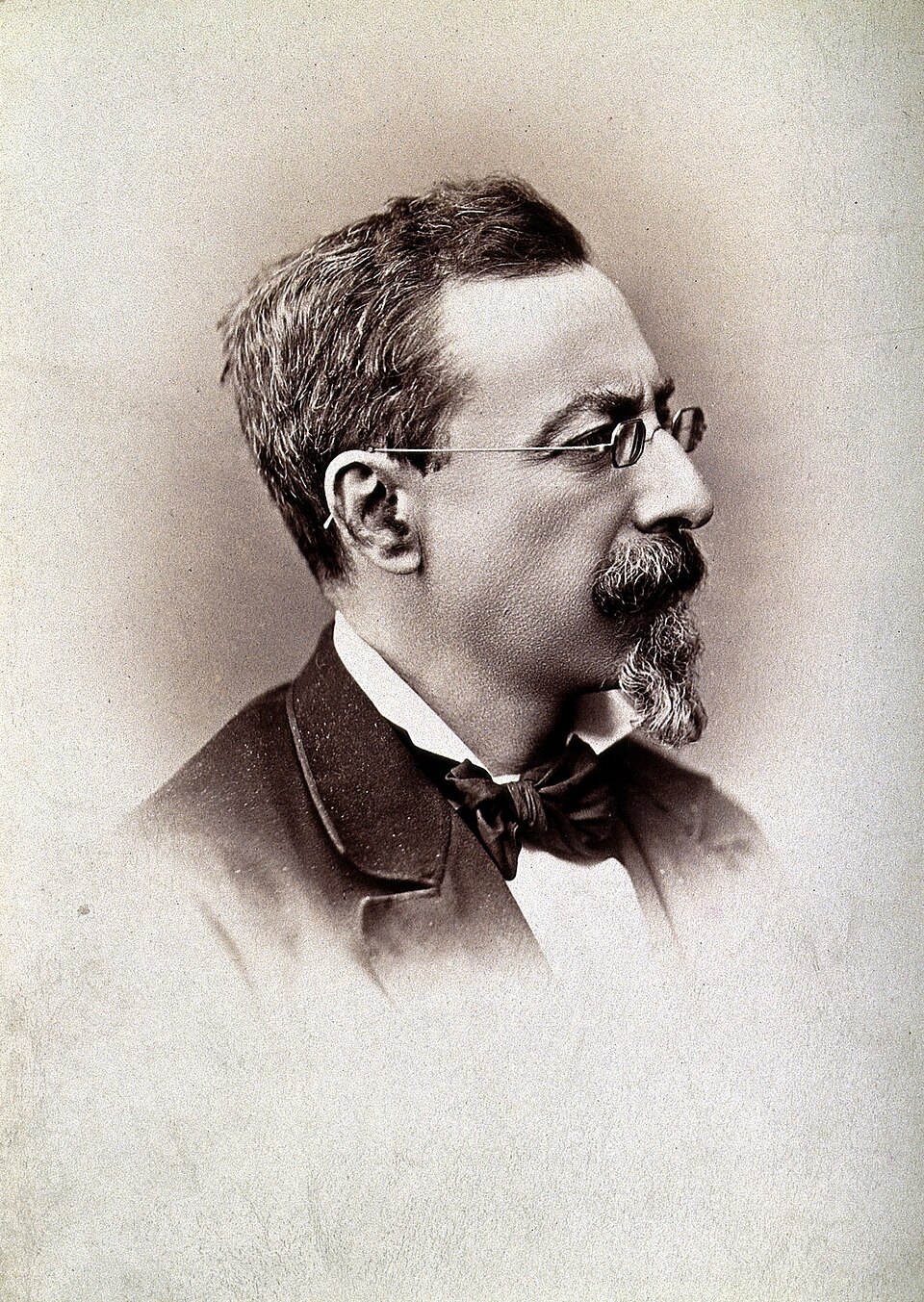 Alfonso L