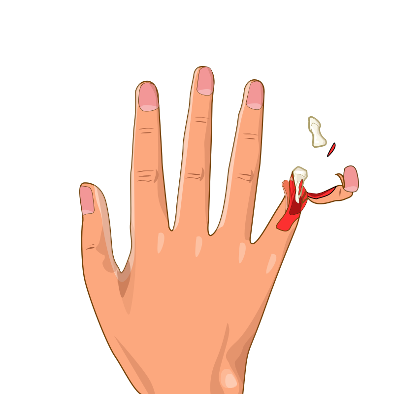 Bencardino