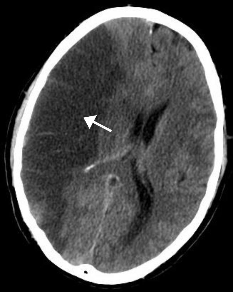 Brain Hsieh