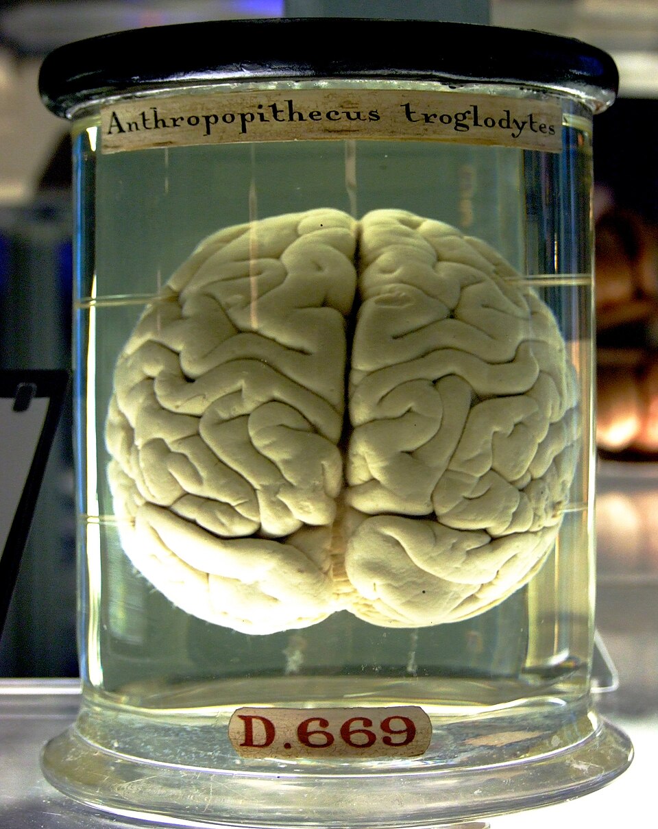 Brainy