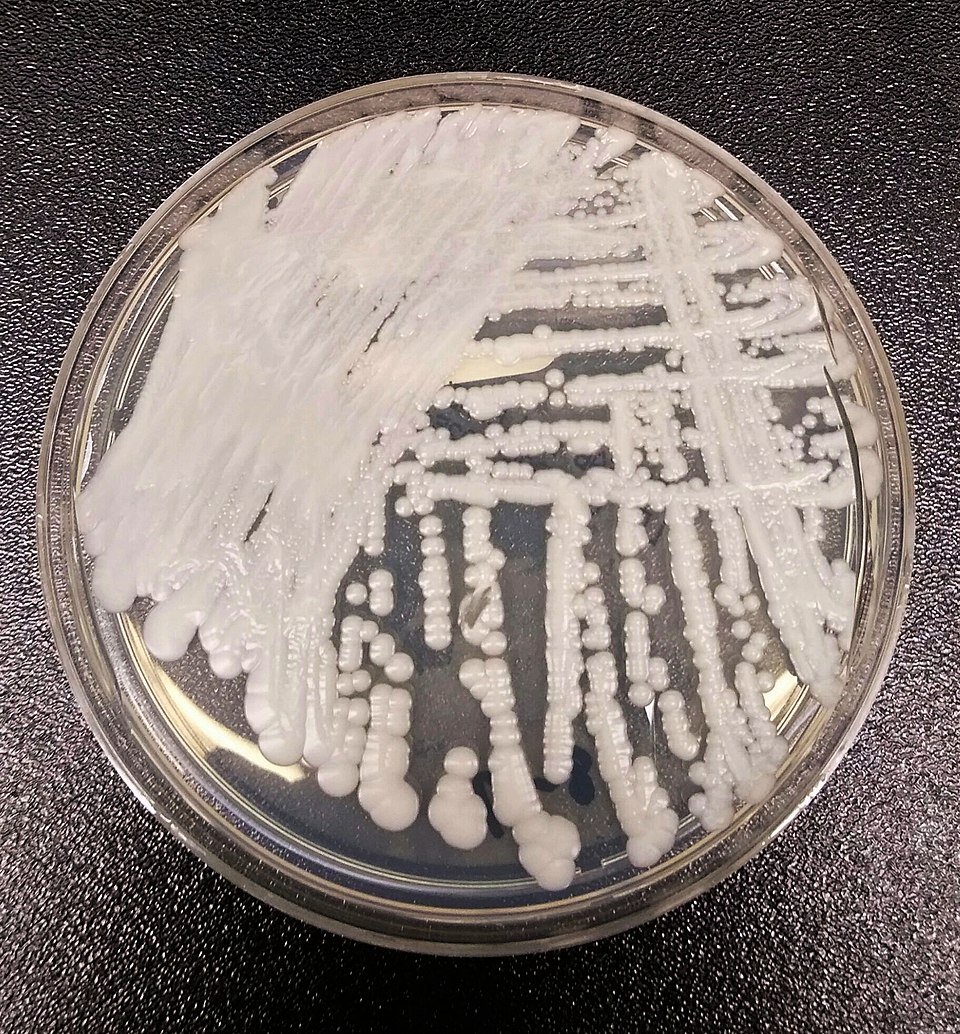 Candida Joseph