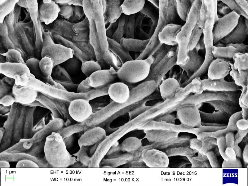 Candida Ng