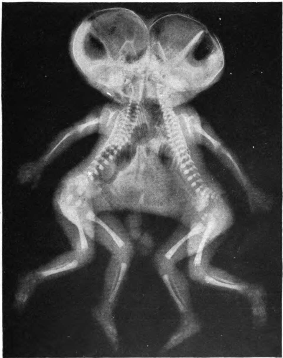Cléa Fortuné