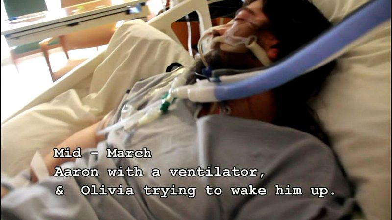 Coma