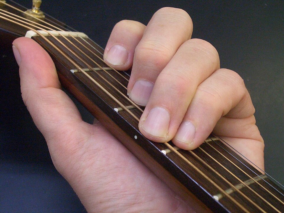 Fretes