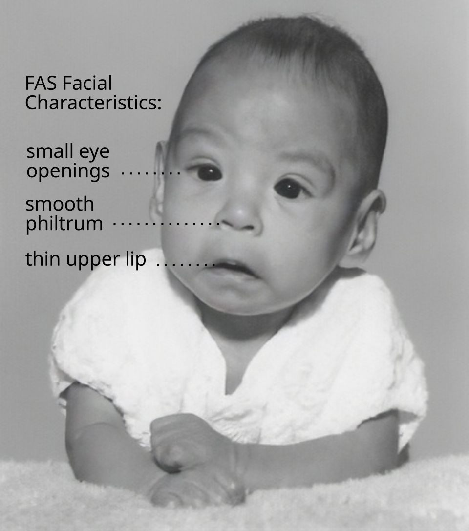 Julie Fetal