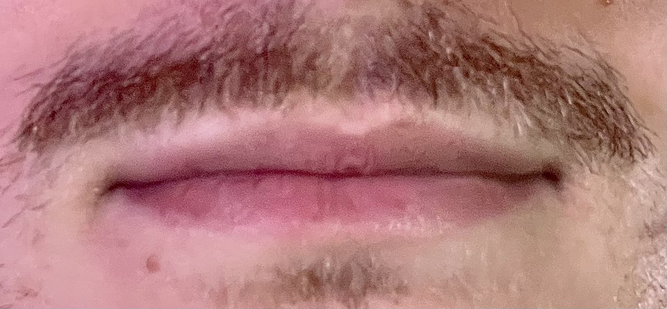 Lips