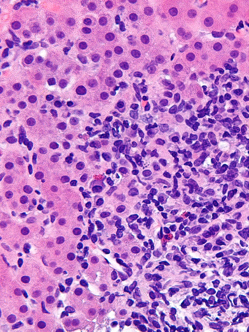 Liver Gomes