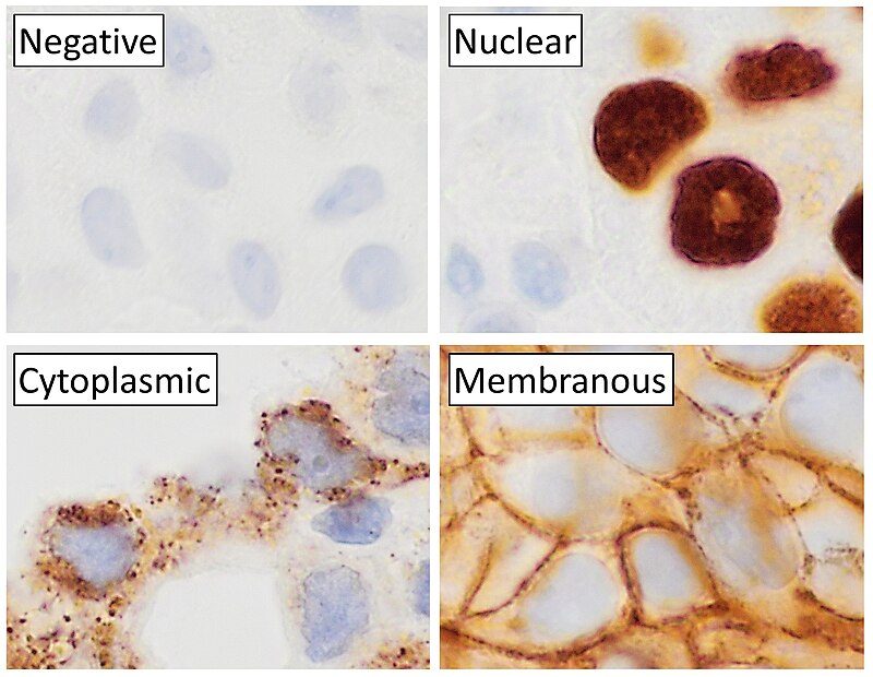 Pr Kaliyappan