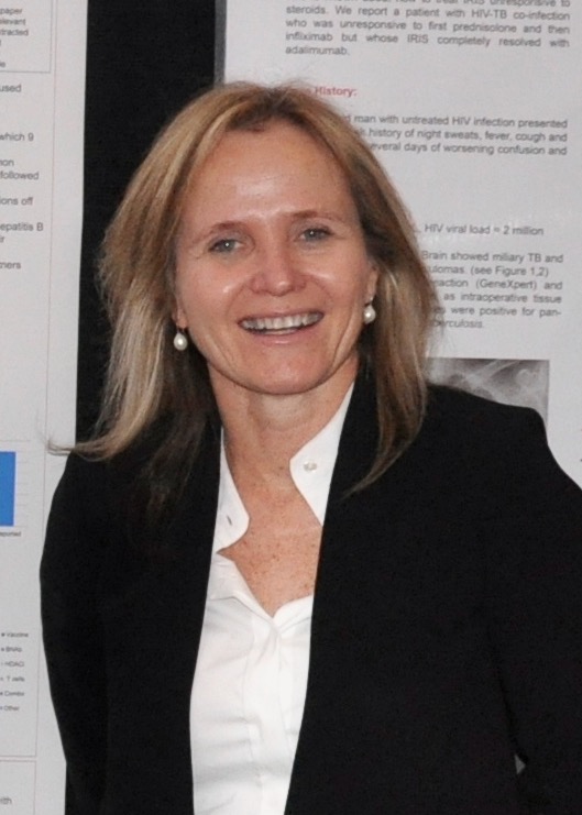 Sharon Lewin
