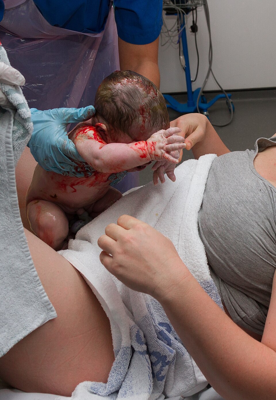 Society For Maternal Fetal Medicine